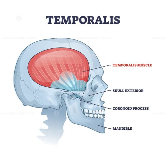 temporalis outline diagram 1