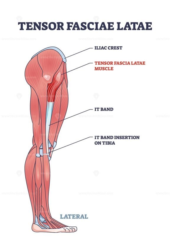 tensor fasciae latae v2 diagram 1