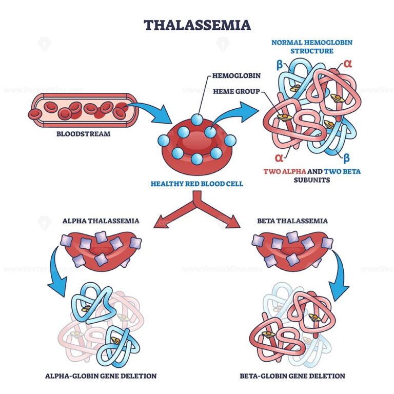 Thalassemia blood disease as hemoglobin structure deletion outline ...