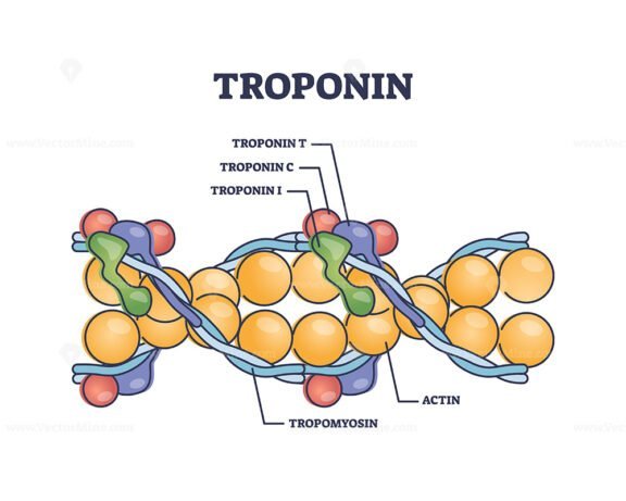 troponin outline 1