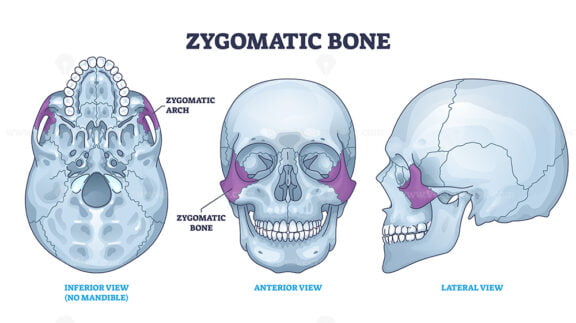 Zygomatic bone location with human skull skeleton anatomy outline diagram